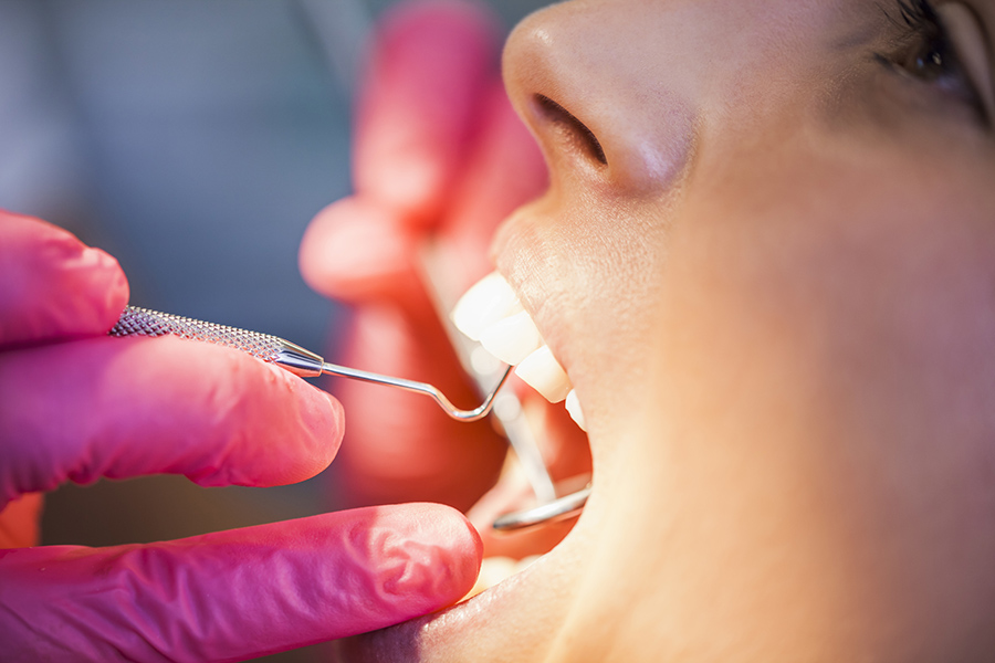С чего начать лечение зубов?